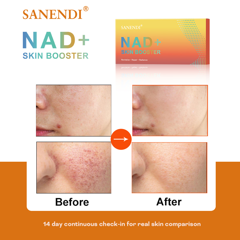 Sanendi NAD+ Korea Skincare Pr - Korean Skincare Routine ulasan dan harga